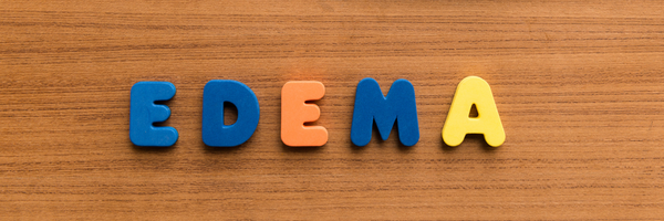 All About Edema - Reduce Edema Swelling Naturally