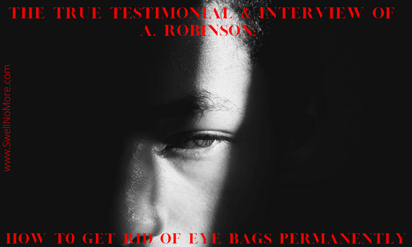The True Testimonial & Interview of A. Robinson:  How To Get Rid Of Eye Bags Permanently